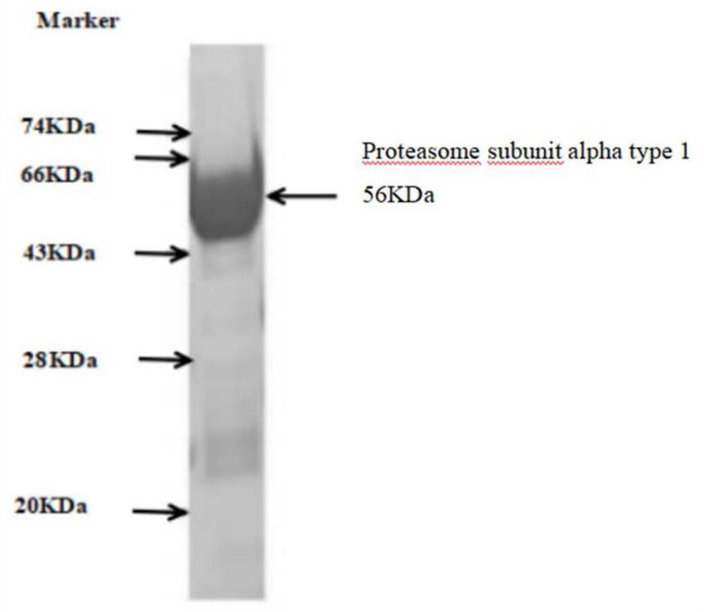 A kit for detecting anti-proteasome subunit α1-igg antibody