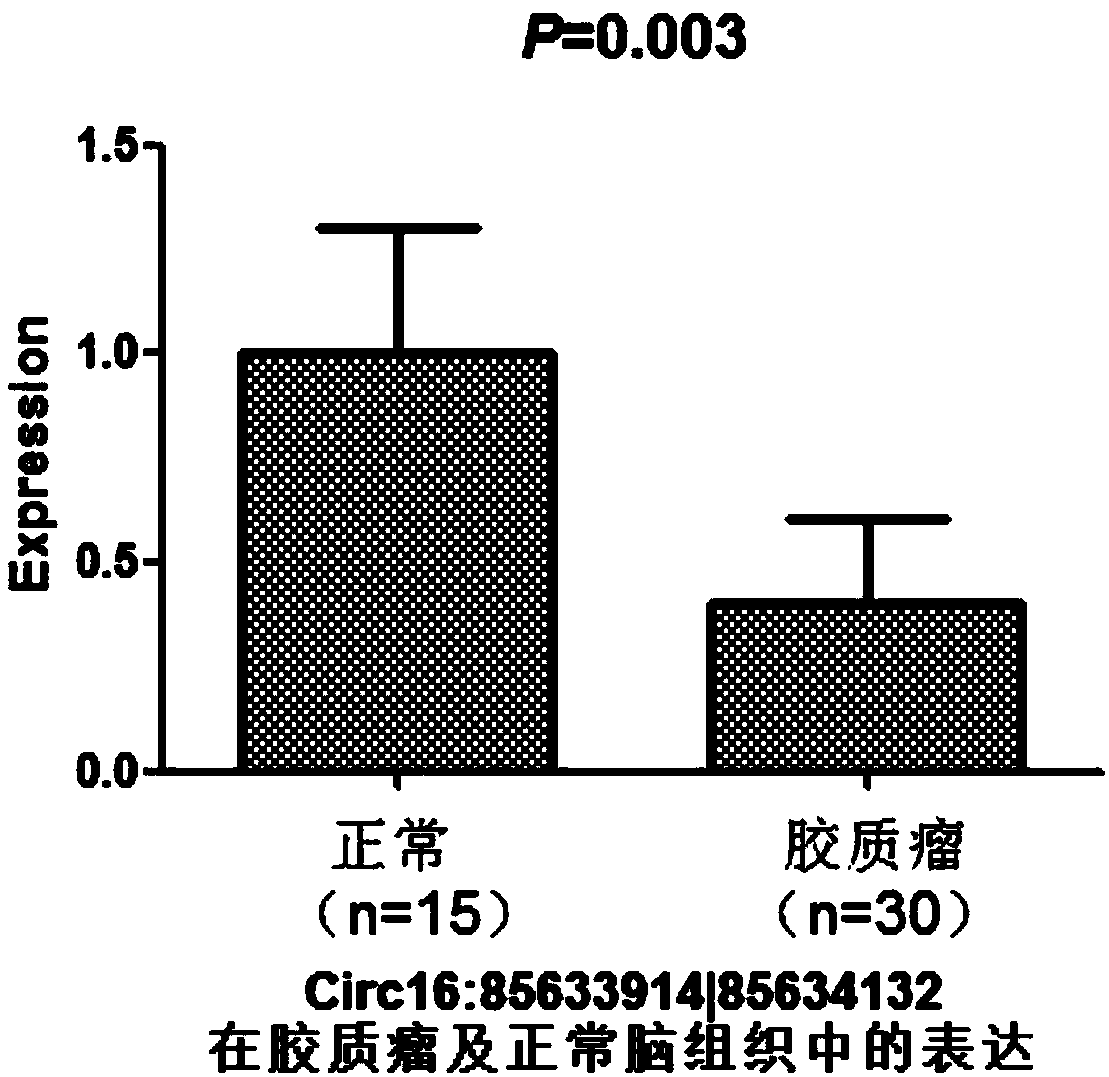 Glioma diagnosis and prognosis marker circ16:85633914|85634132 and application