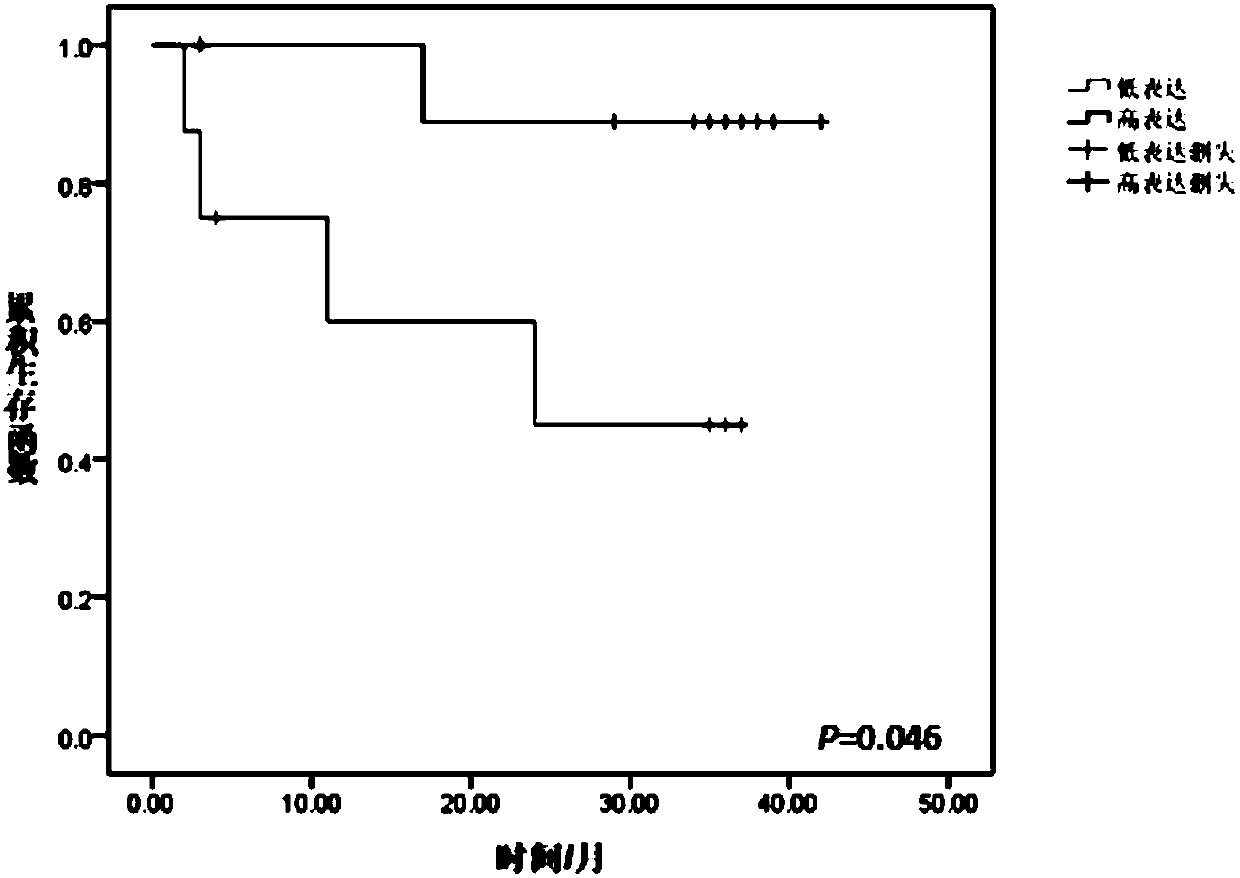 Glioma diagnosis and prognosis marker circ16:85633914|85634132 and application