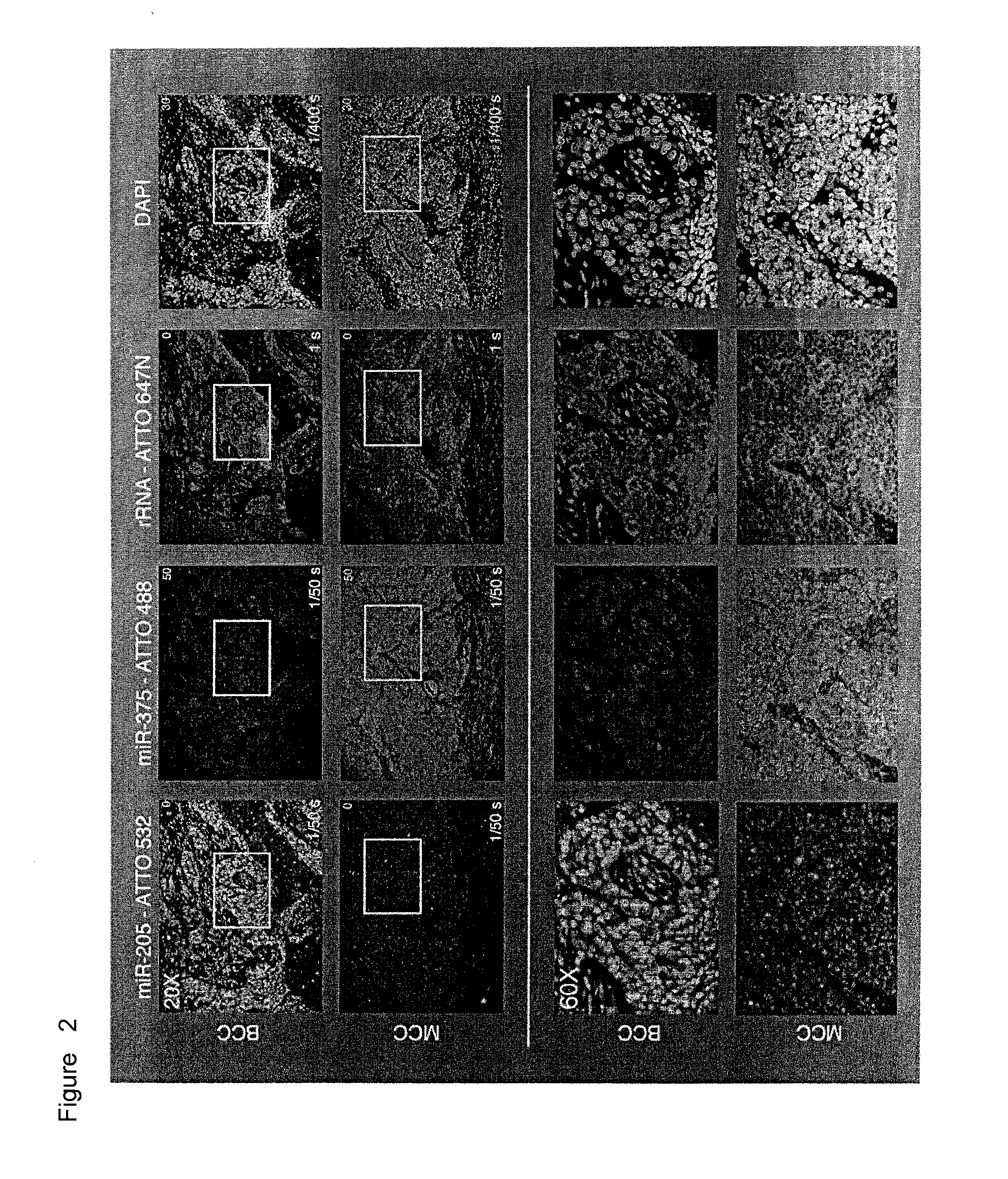 Methods for fixing and detecting RNA