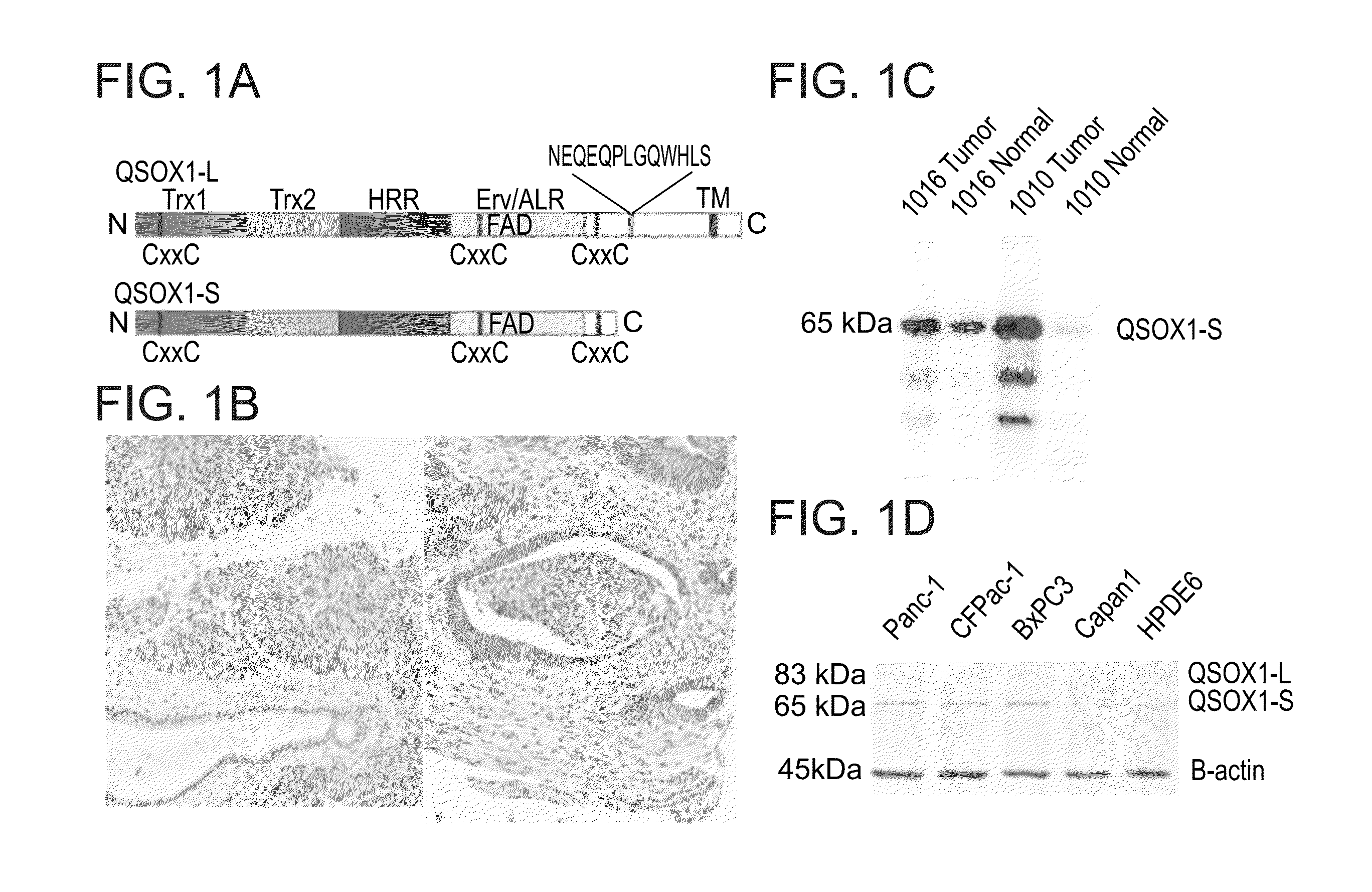 Qsox1 as an Anti-neoplastic drug target