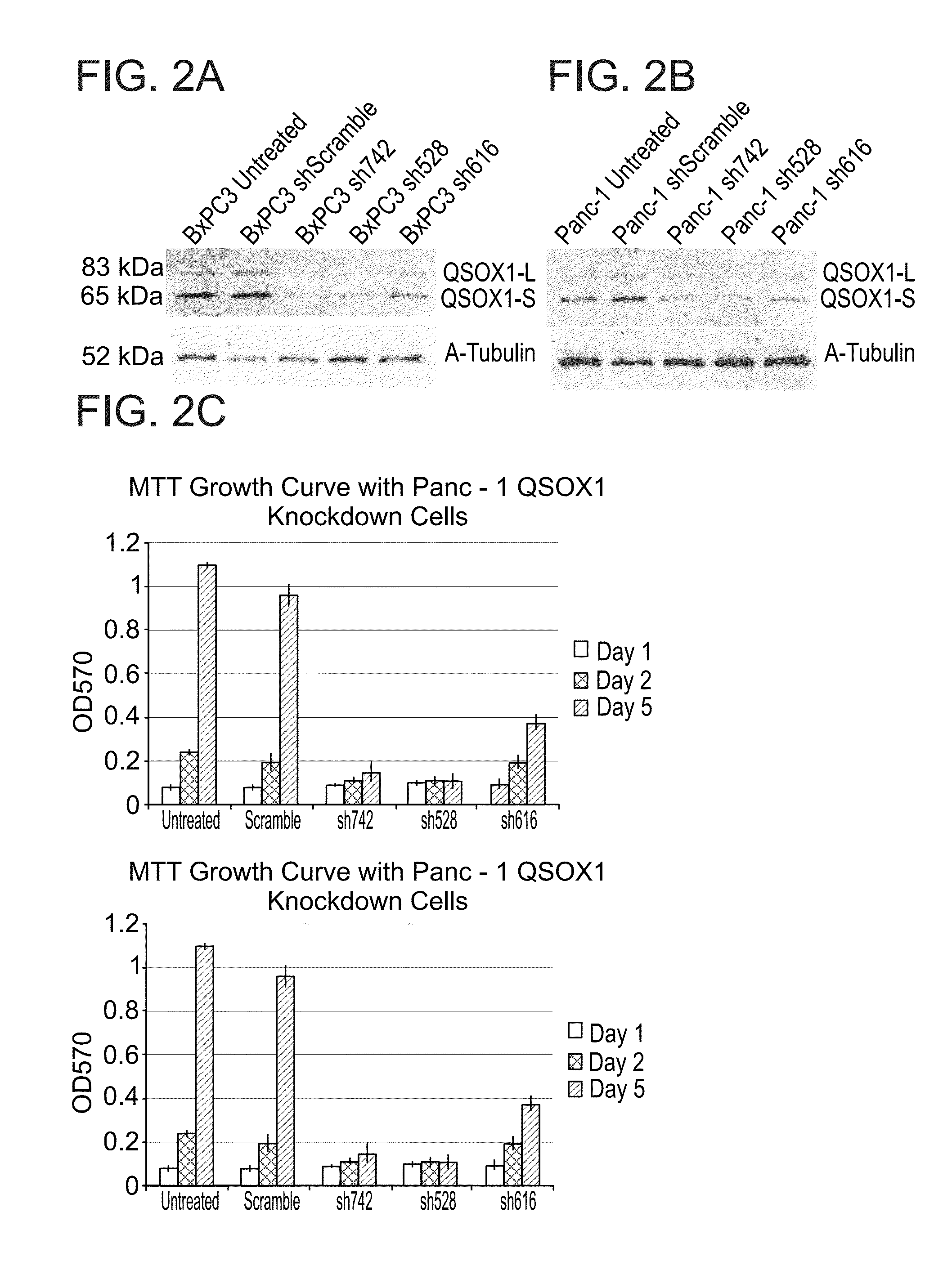 Qsox1 as an Anti-neoplastic drug target