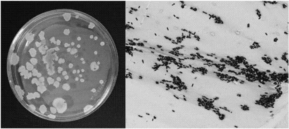 Application of fucoidan for enhancing storage stability of biological peptides