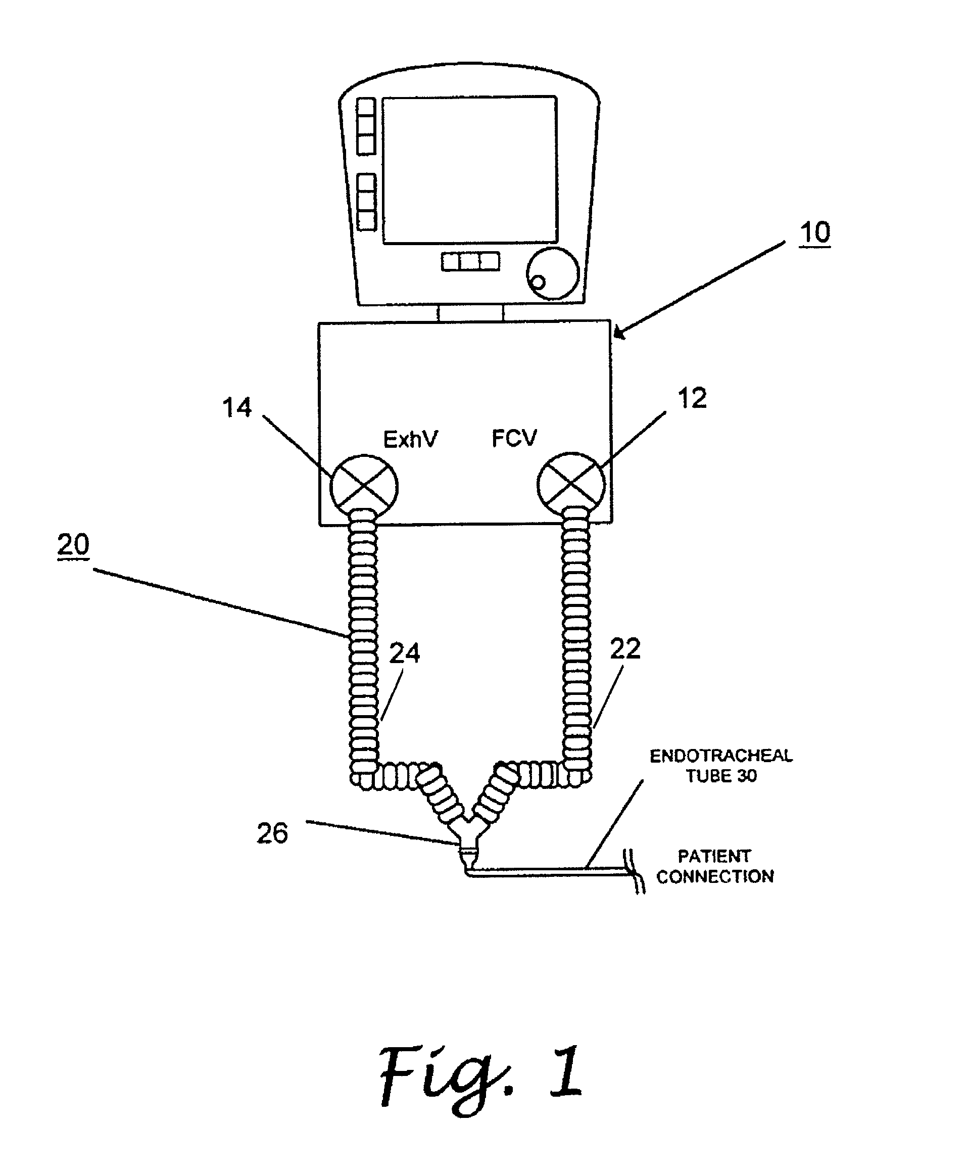 Patient circuit disconnect system for a ventilator and method of detecting patient circuit disconnect