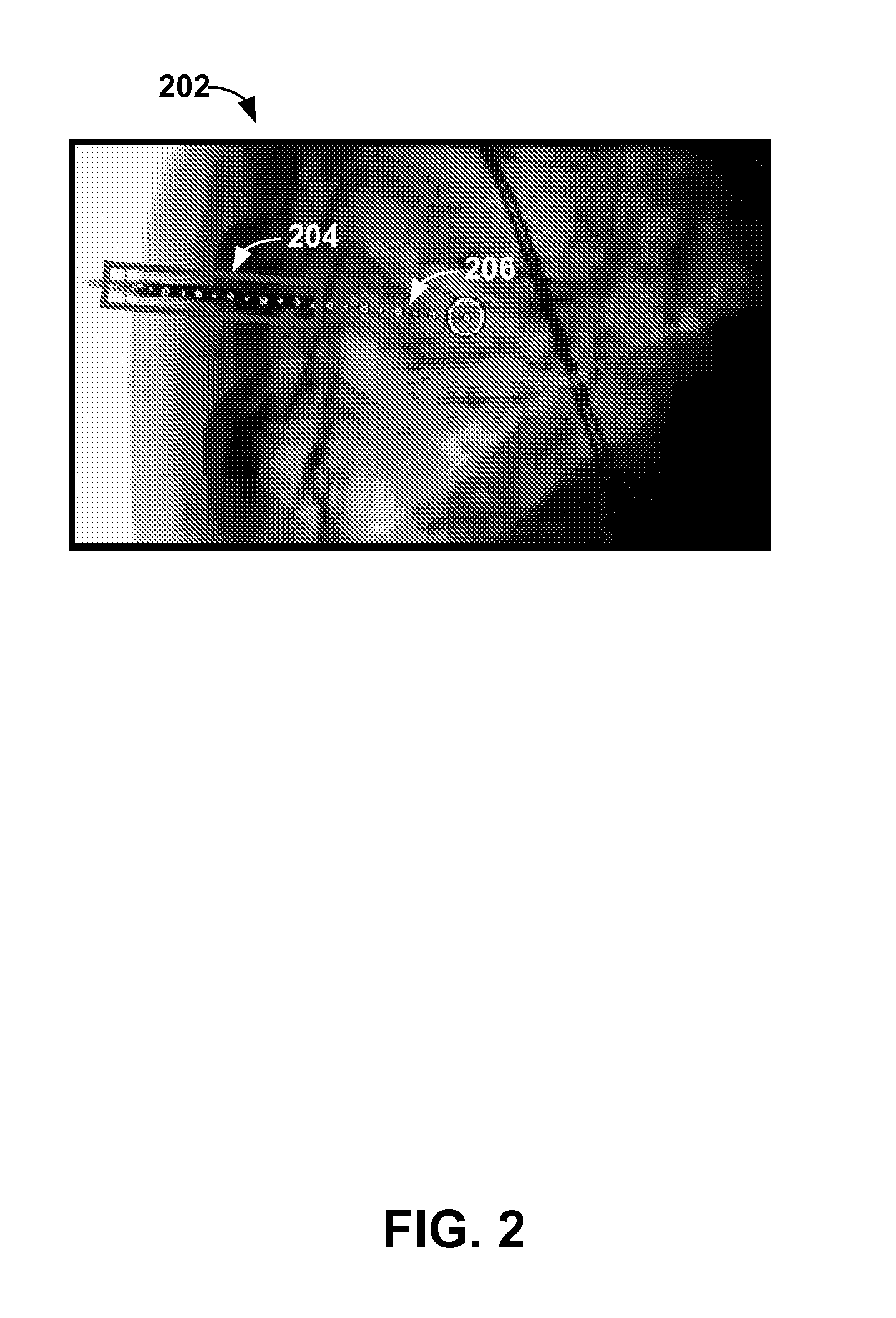 Method and system for obtaining a sequence of x-ray images using a reduced dose of ionizing radiation