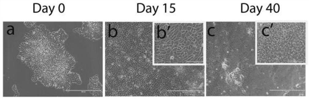 Corneal epithelial cells and corneal stent as well as preparation method and application thereof