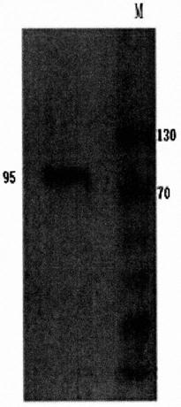 Tetravalent ciliary protein immunogen of enterotoxigenic escherichia coli and preparation method thereof