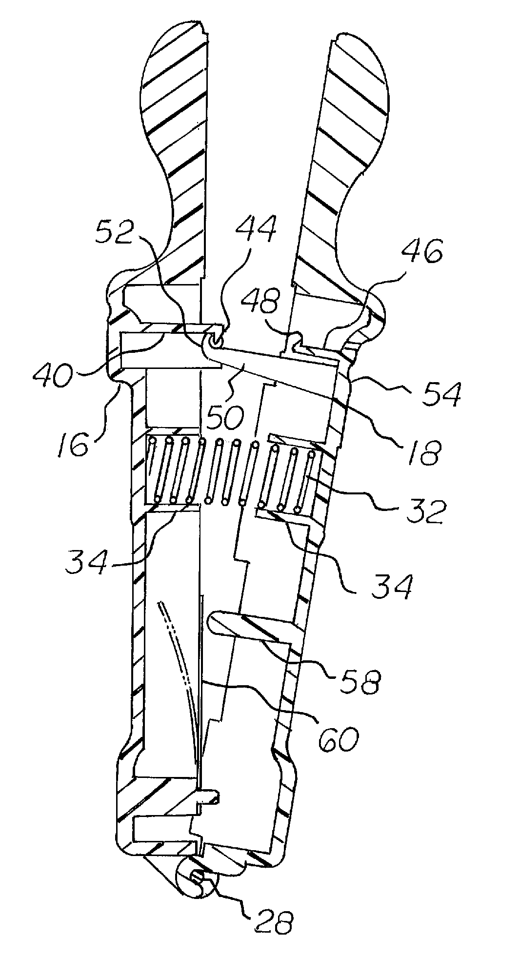Incontinency abatement system