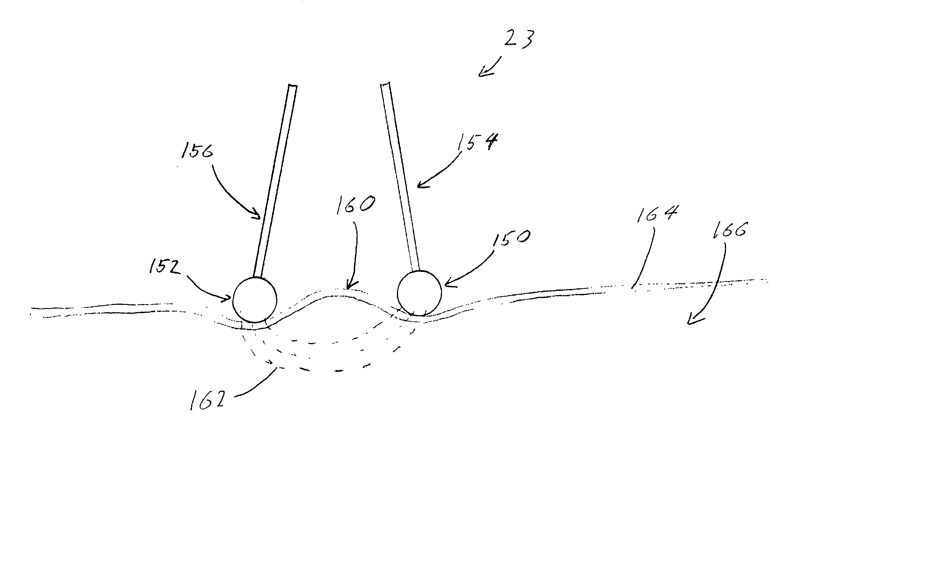 Systems and methods for intradermal collagen stimulation