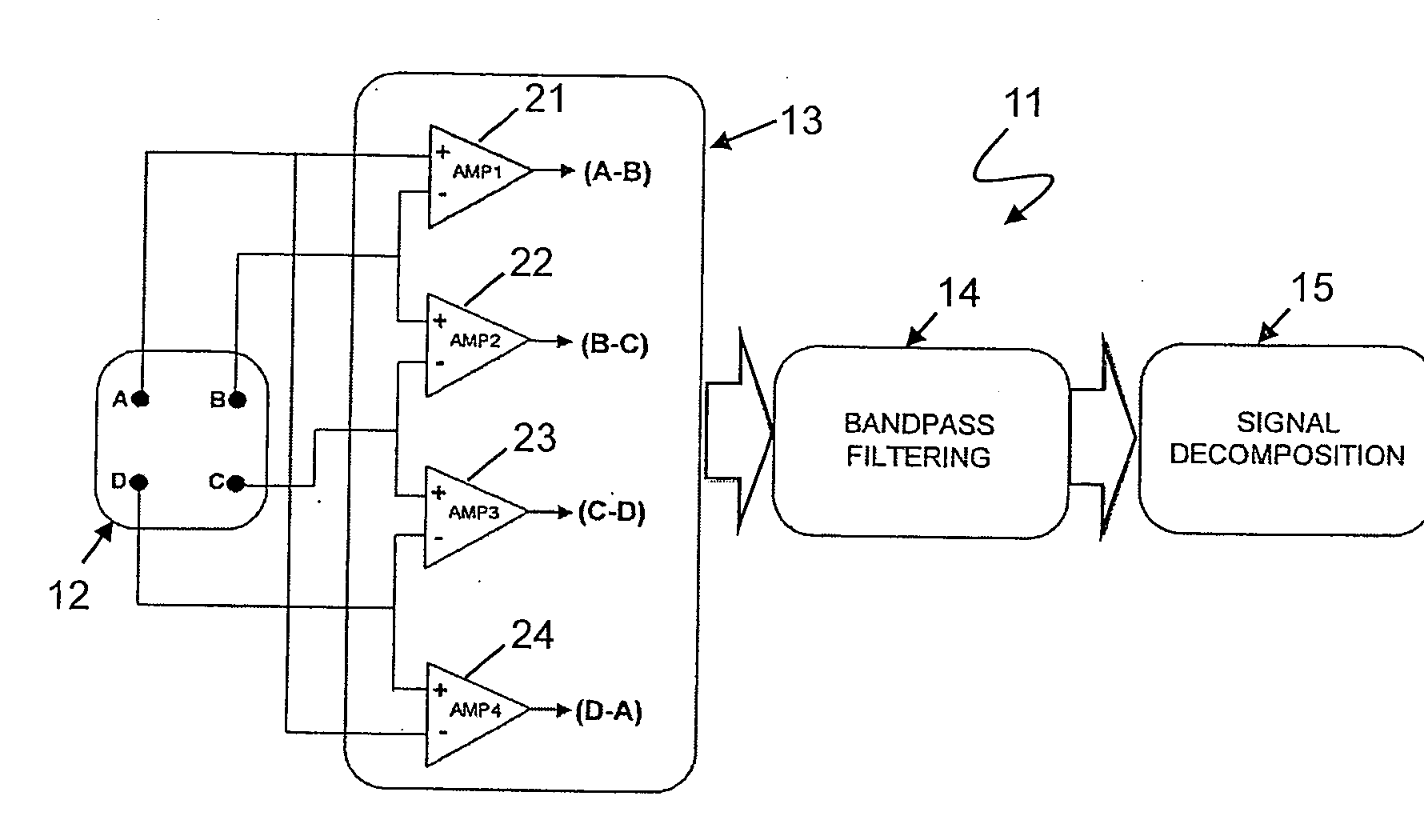 Sensor system for detecting and processing EMG signals