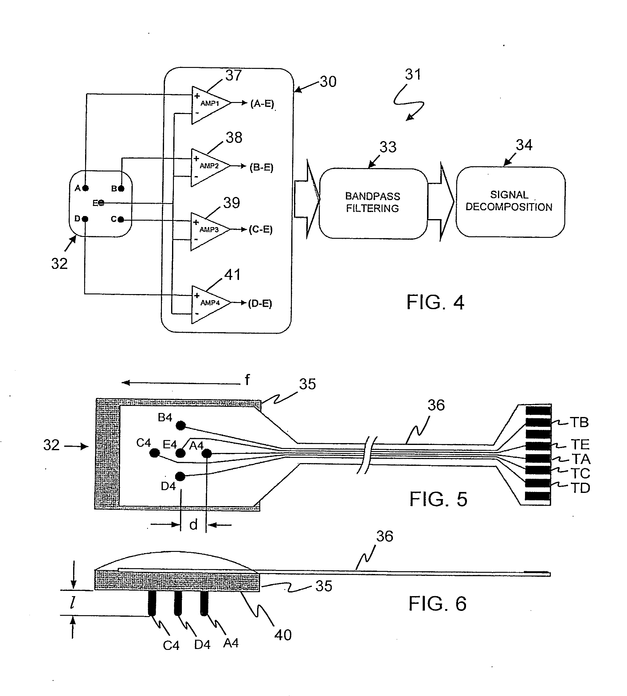 Sensor system for detecting and processing EMG signals