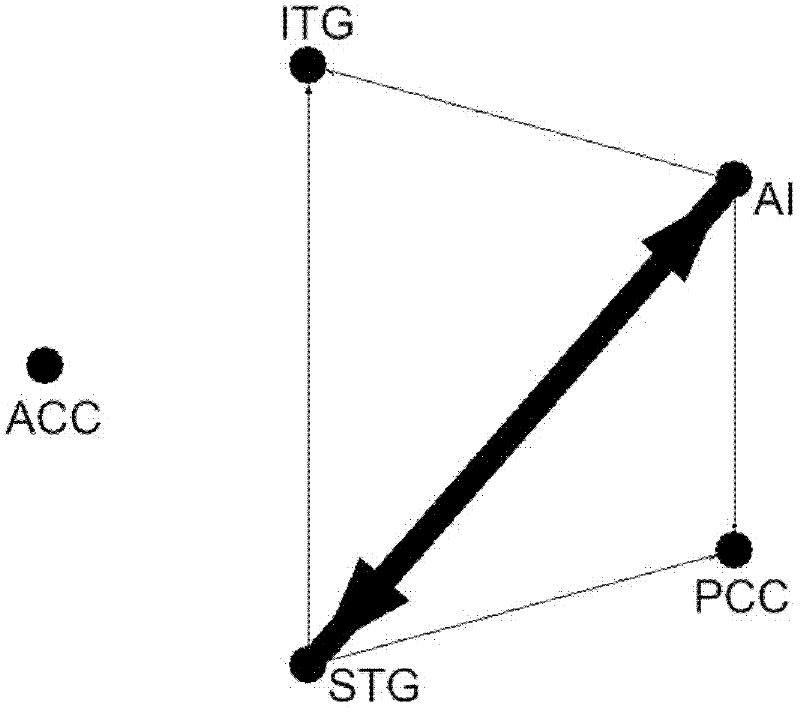 Detection method for causal connection strength of magnetic resonance brain imaging based on PCA (Principal component analysis) and GCA (Granger causality analysis)