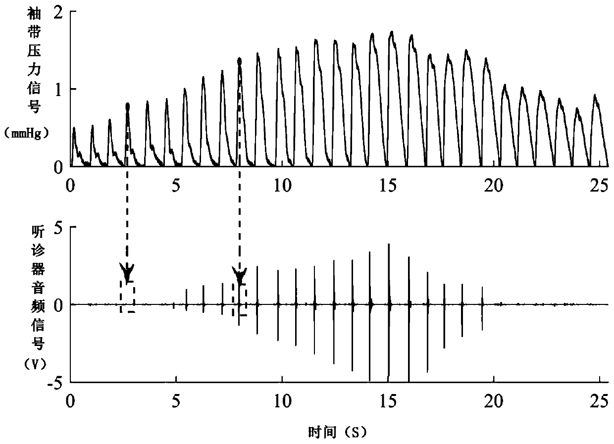 Stethoscope audio data processing method based on deep learning