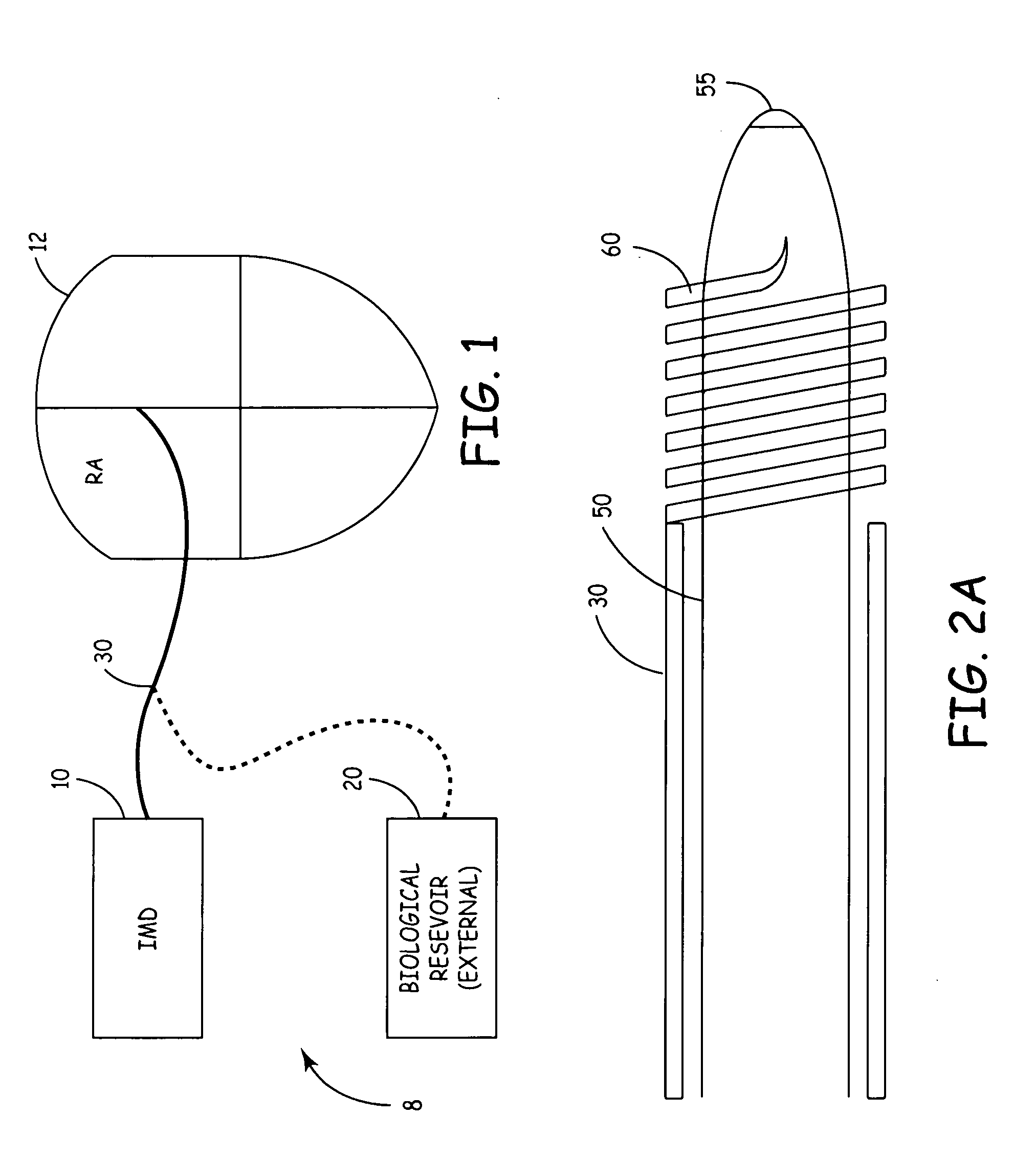 System for the delivery of a biologic therapy with device monitoring and back-up