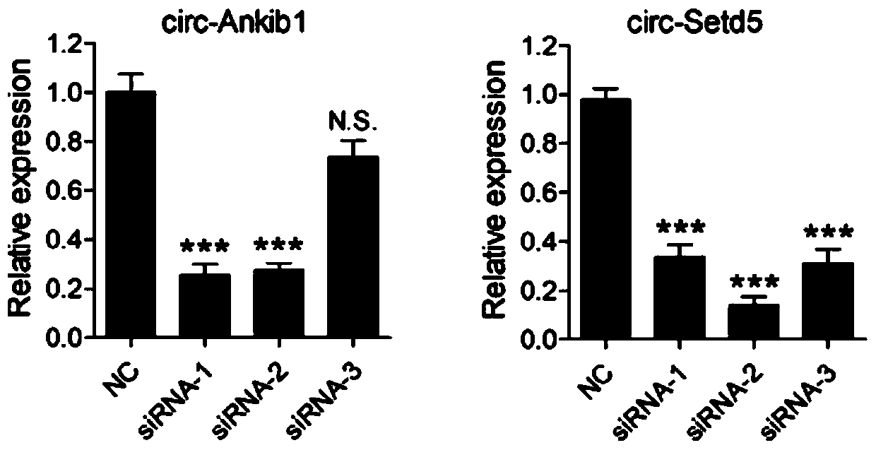 Application of circular RNA circ-Ankib1 in preparation of medicament for promoting nerve regeneration and repairing nerve injury