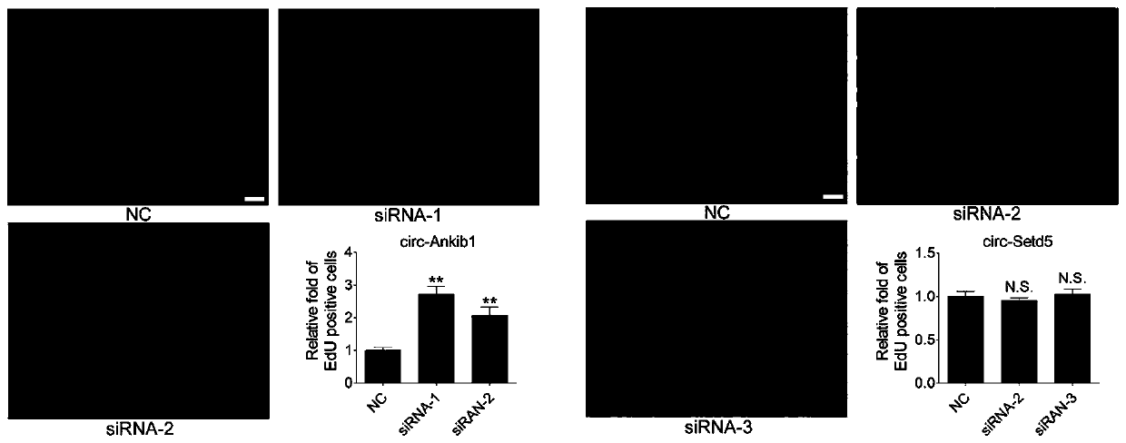 Application of circular RNA circ-Ankib1 in preparation of medicament for promoting nerve regeneration and repairing nerve injury