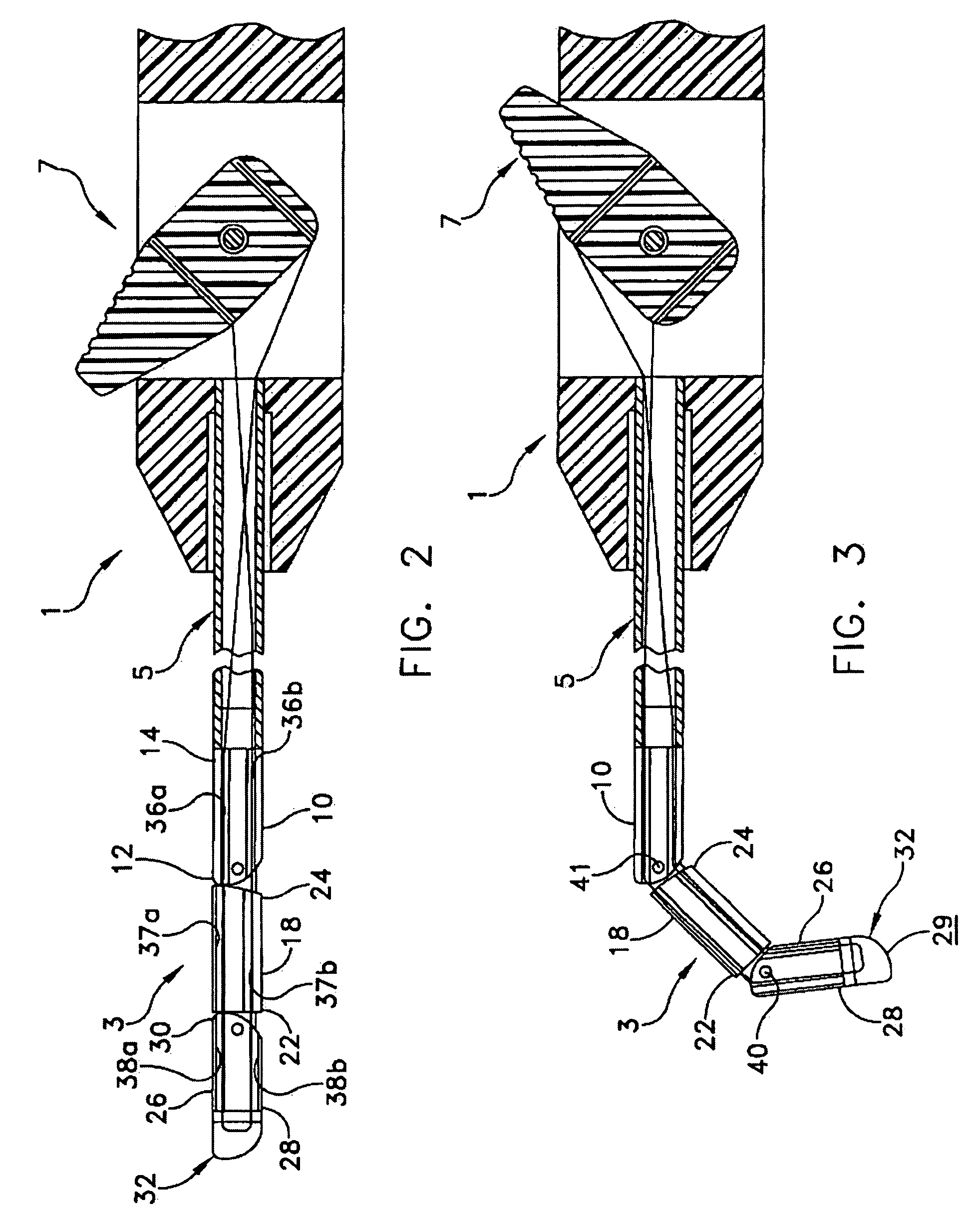 Articulated surgical probe and method for use