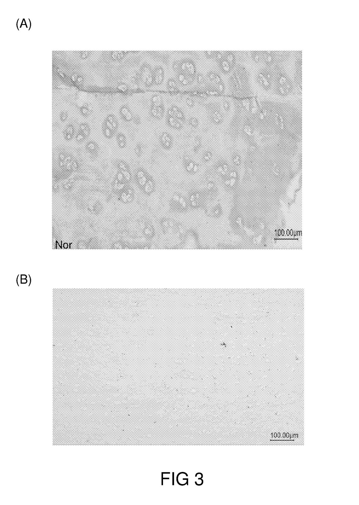 Preparation of acellular cartilage graft and uses thereof