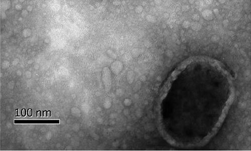 Exosomal biomarker for auxiliary diagnosis of SCA3/MJD and screening and identification method thereof