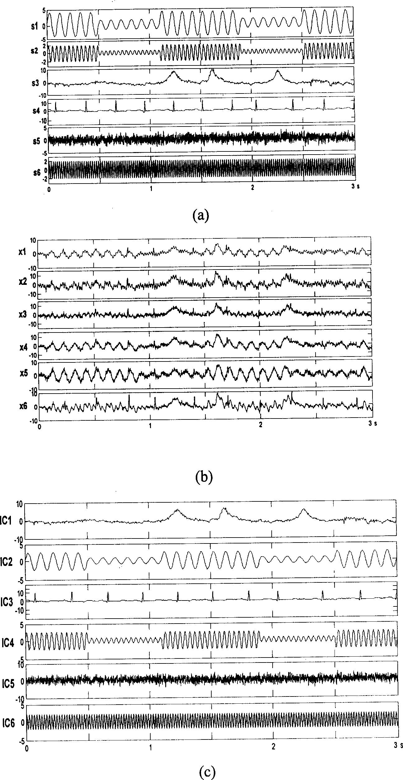 A method for automatically detecting and removing artifacts from EEG signal