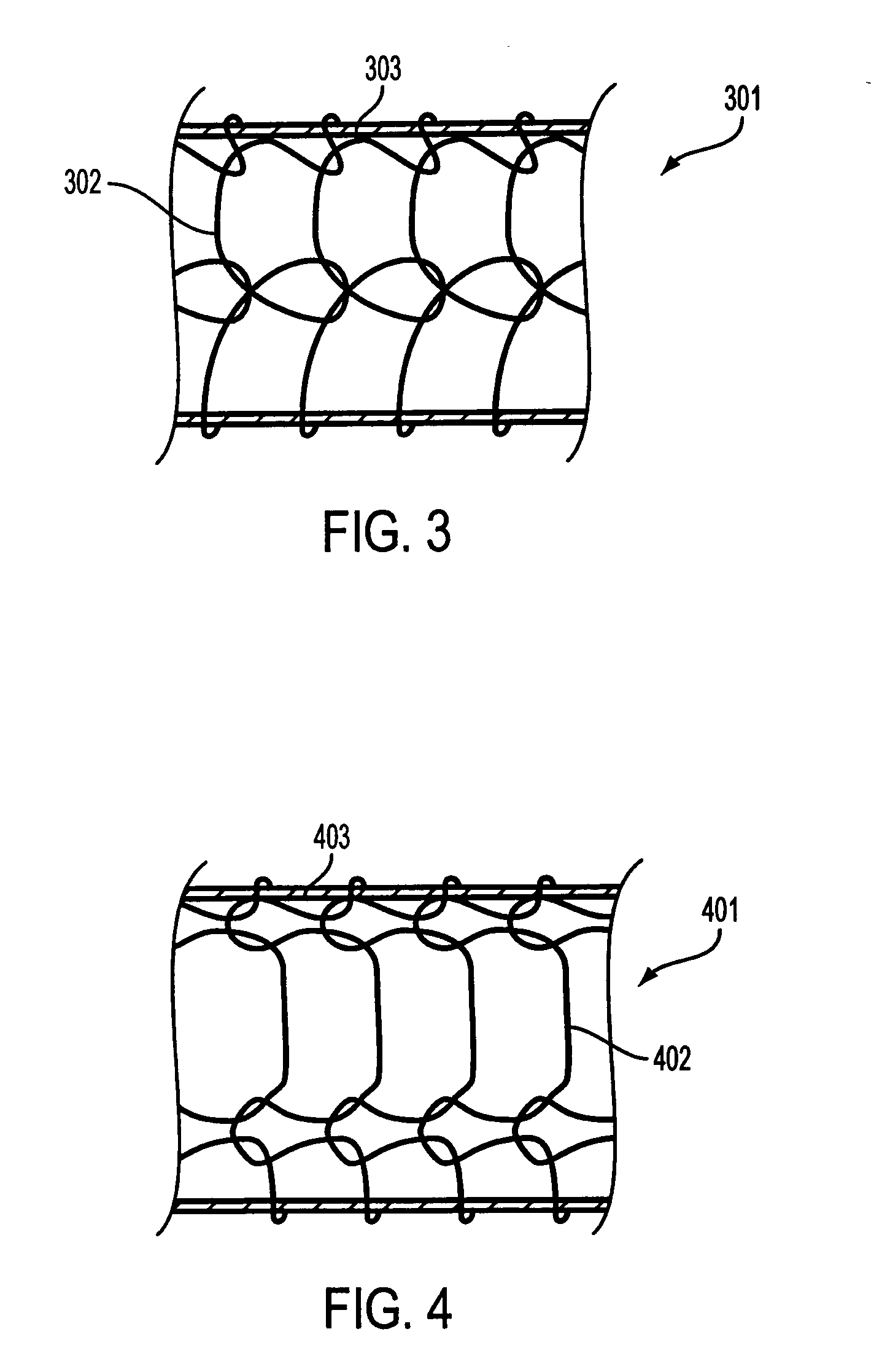 Composite stent with inner and outer stent elements and method of using the same