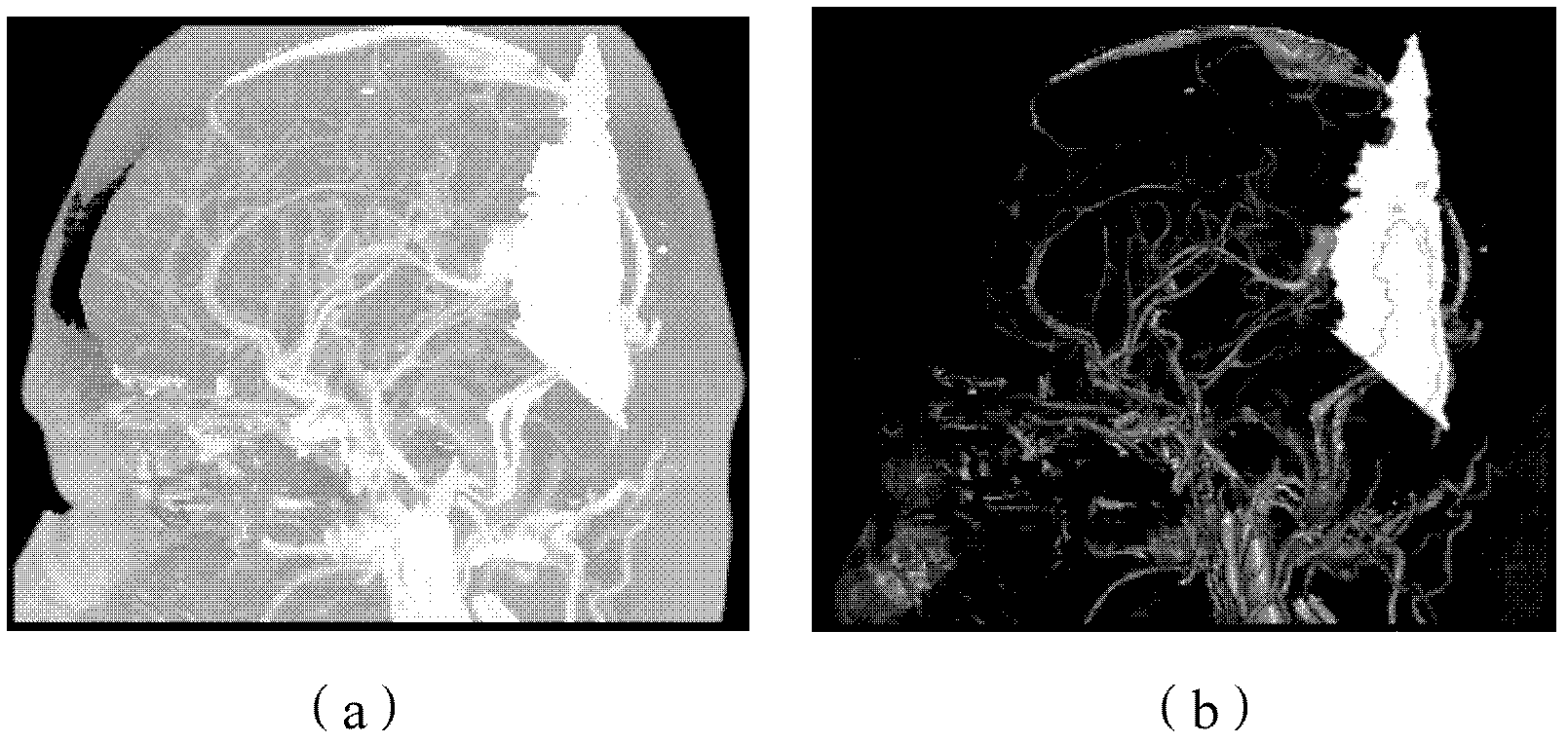 Method and device for removing scanning table from CTA (Computed Tomography Angiography) image