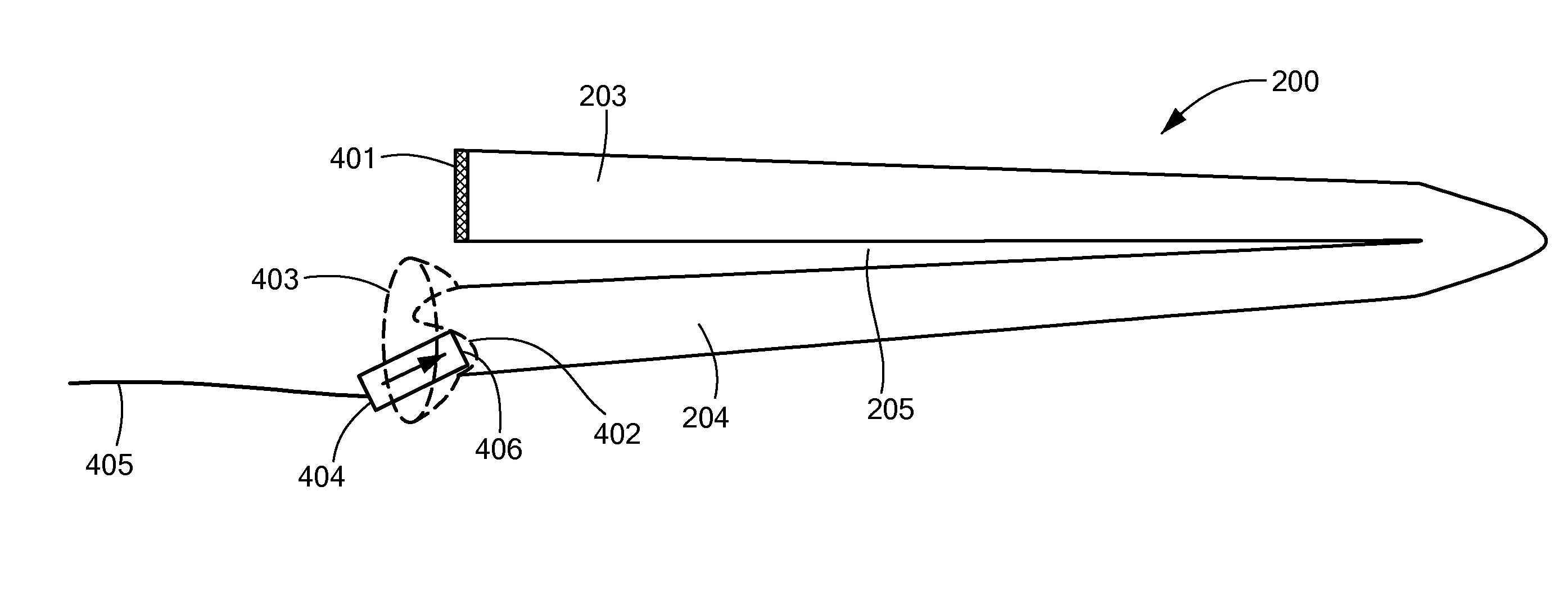 Middle Ear Implant for Otosclerosis