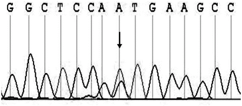 Application of for ABCA3 genes to detecting congenital CCMC (cataract-microcornea syndrome)