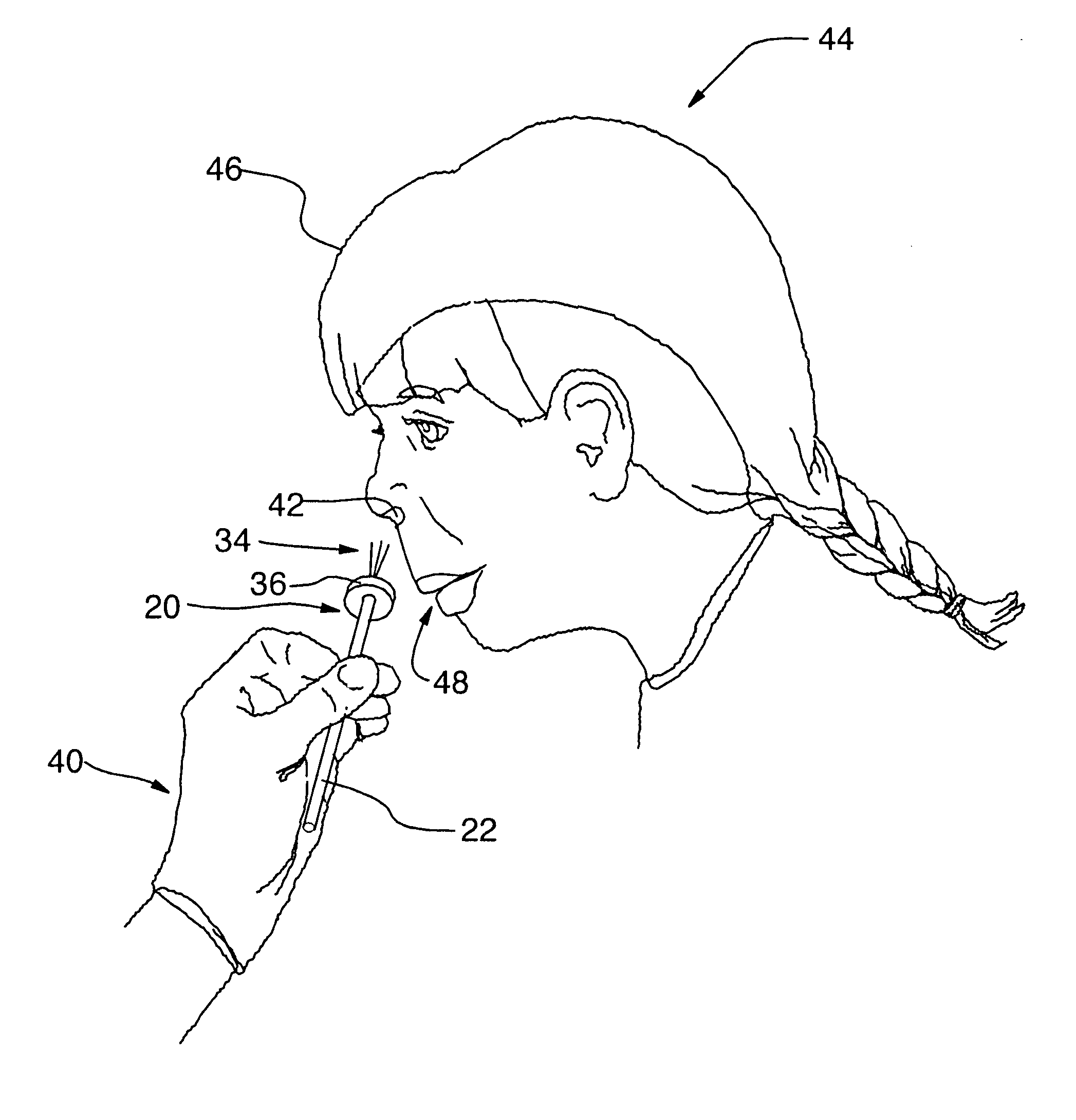 Method and apparatus for alleviating nasal congestion