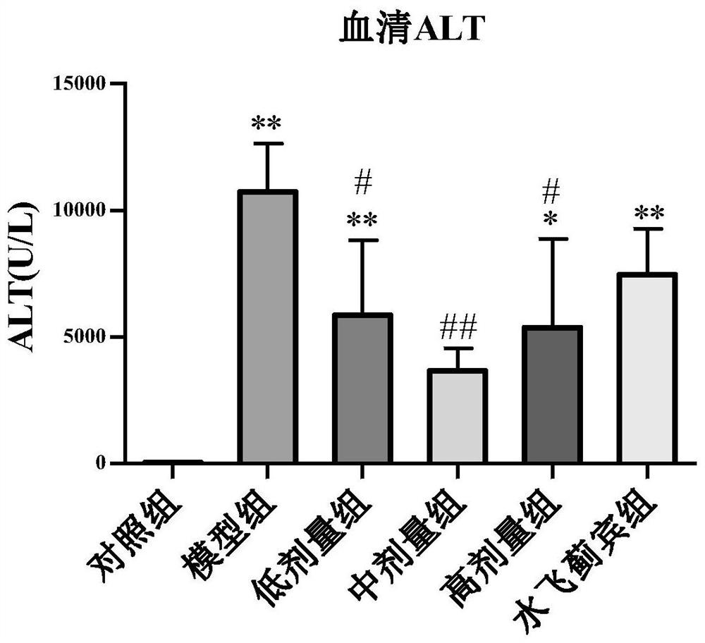 Application of arundic acid in preparation of medicine for treating hepatic fibrosis