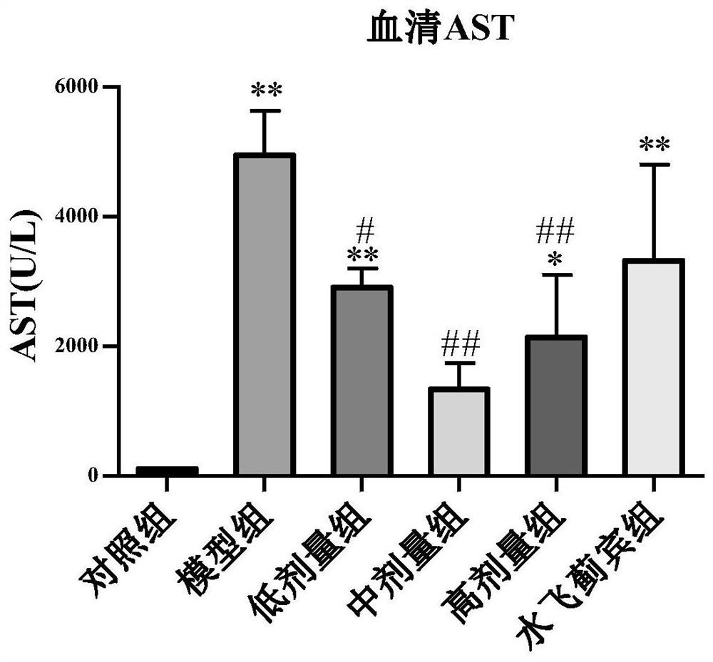 Application of arundic acid in preparation of medicine for treating hepatic fibrosis