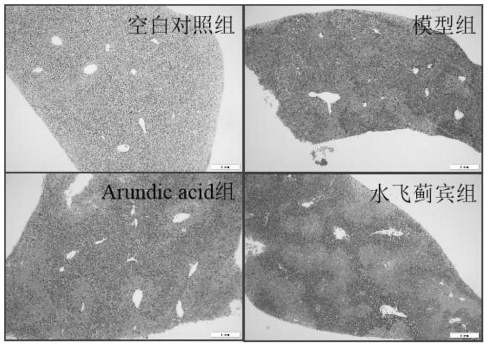 Application of arundic acid in preparation of medicine for treating hepatic fibrosis