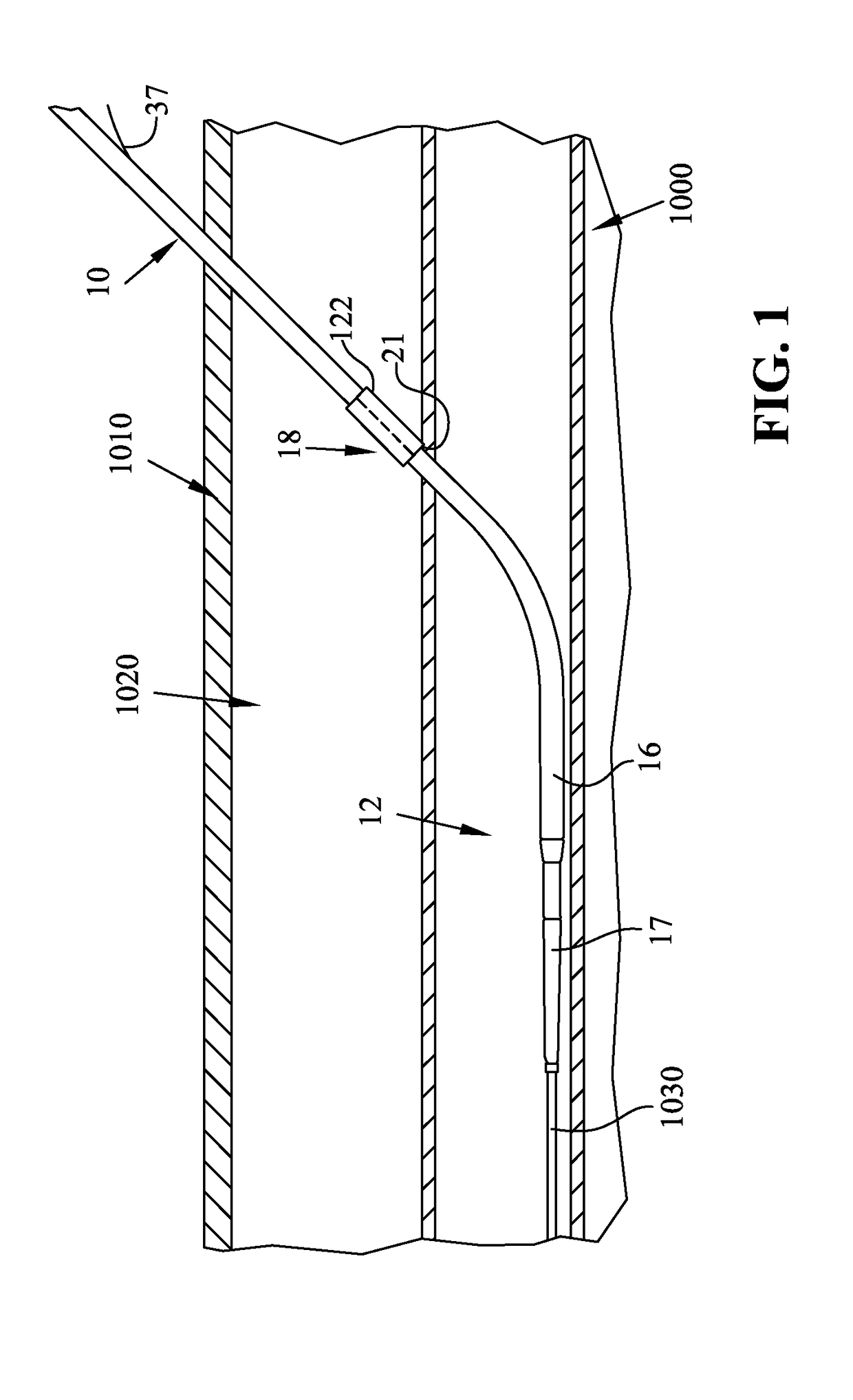 Method and apparatus for sealing access