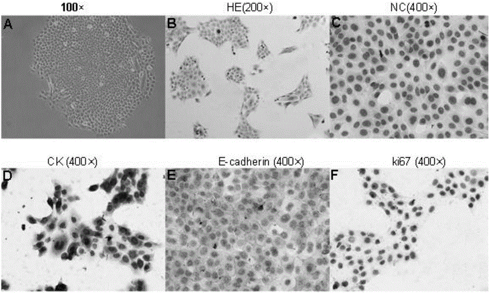 Oral squamous carcinoma cell strain as well as preparation method and applications thereof