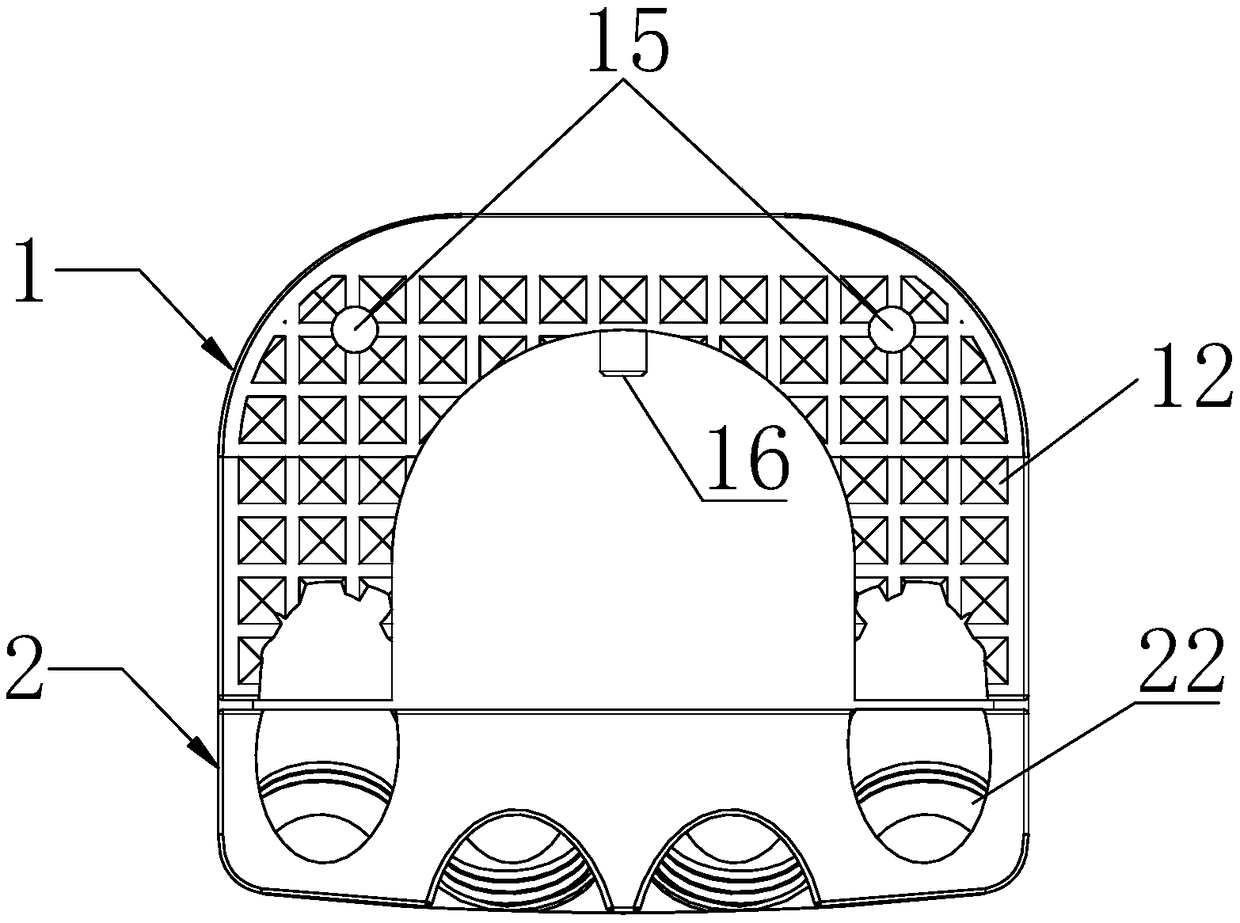 Zero-incisure interbody fusion cage for anterior cervical vertebra