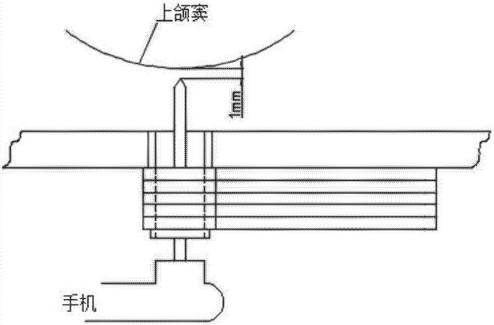 Dental-implantation guide plate tool