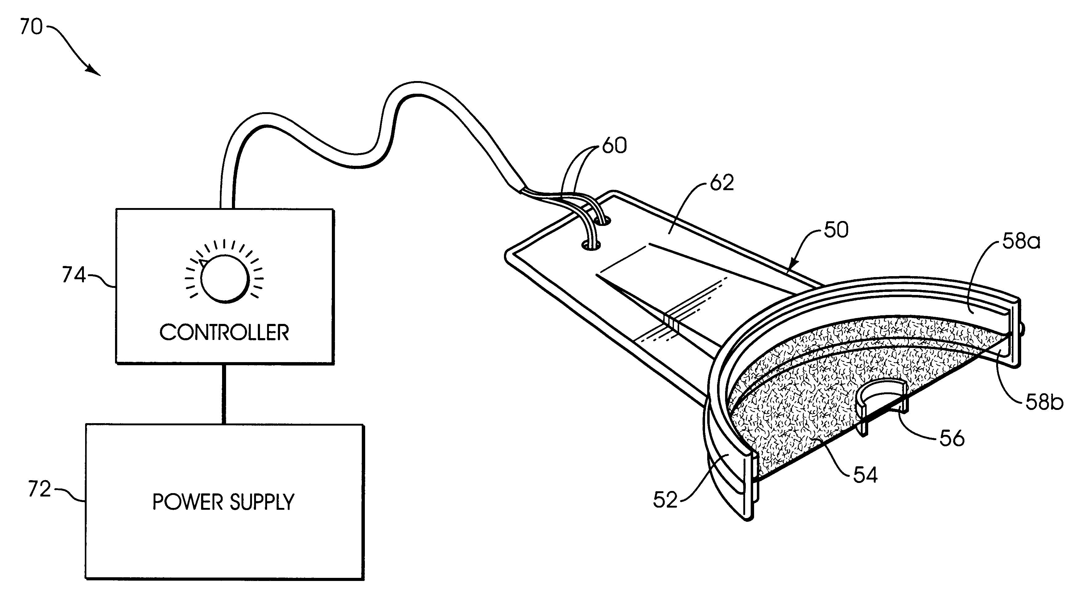 Apparatus and methods for accelerating dental treatments