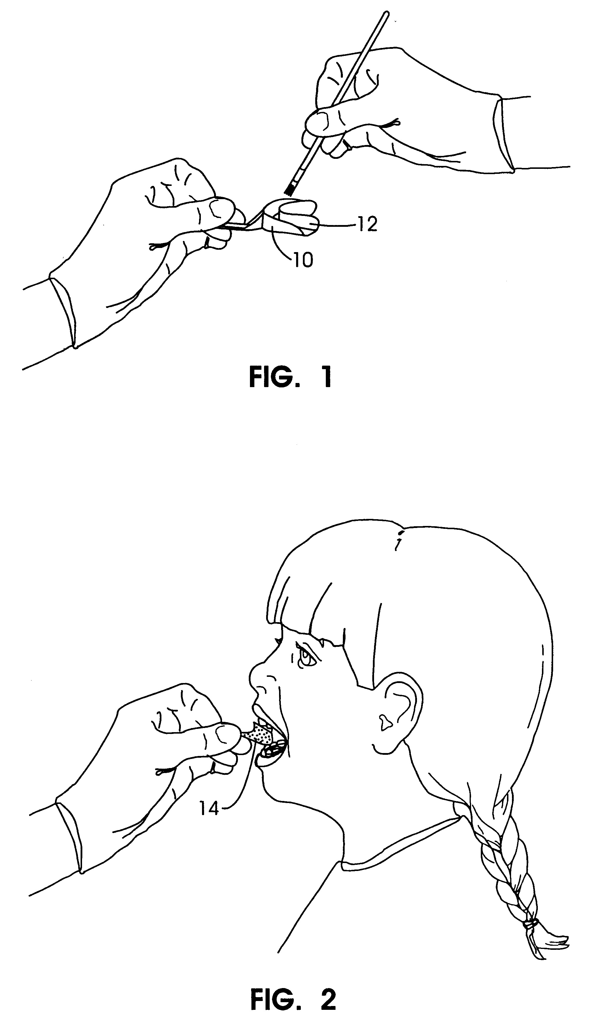 Apparatus and methods for accelerating dental treatments