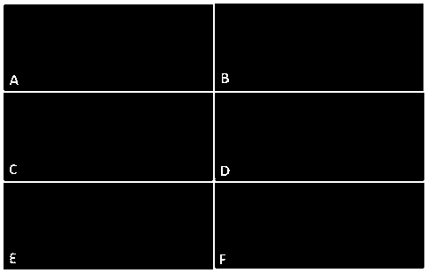 Application of colla corii asini and new colla corii asini composition to preparation of medicines for preventing or treating diseases relevant to blood platelet reduction