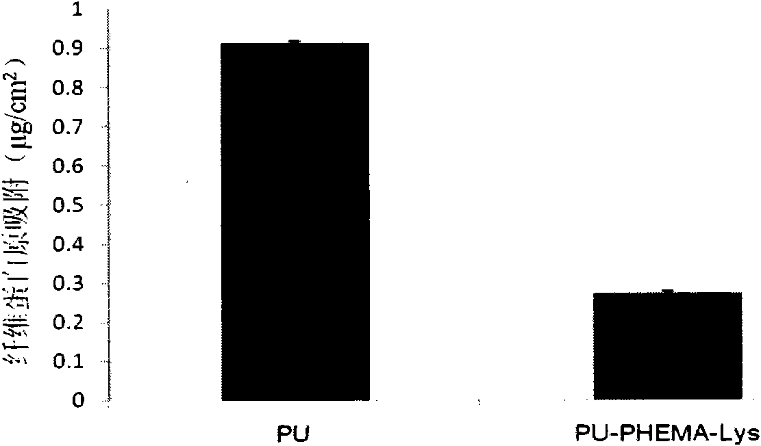 Polyurethane material capable of dissolving plasma clot in high efficiency and preparation thereof