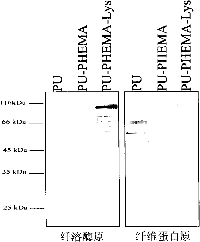 Polyurethane material capable of dissolving plasma clot in high efficiency and preparation thereof