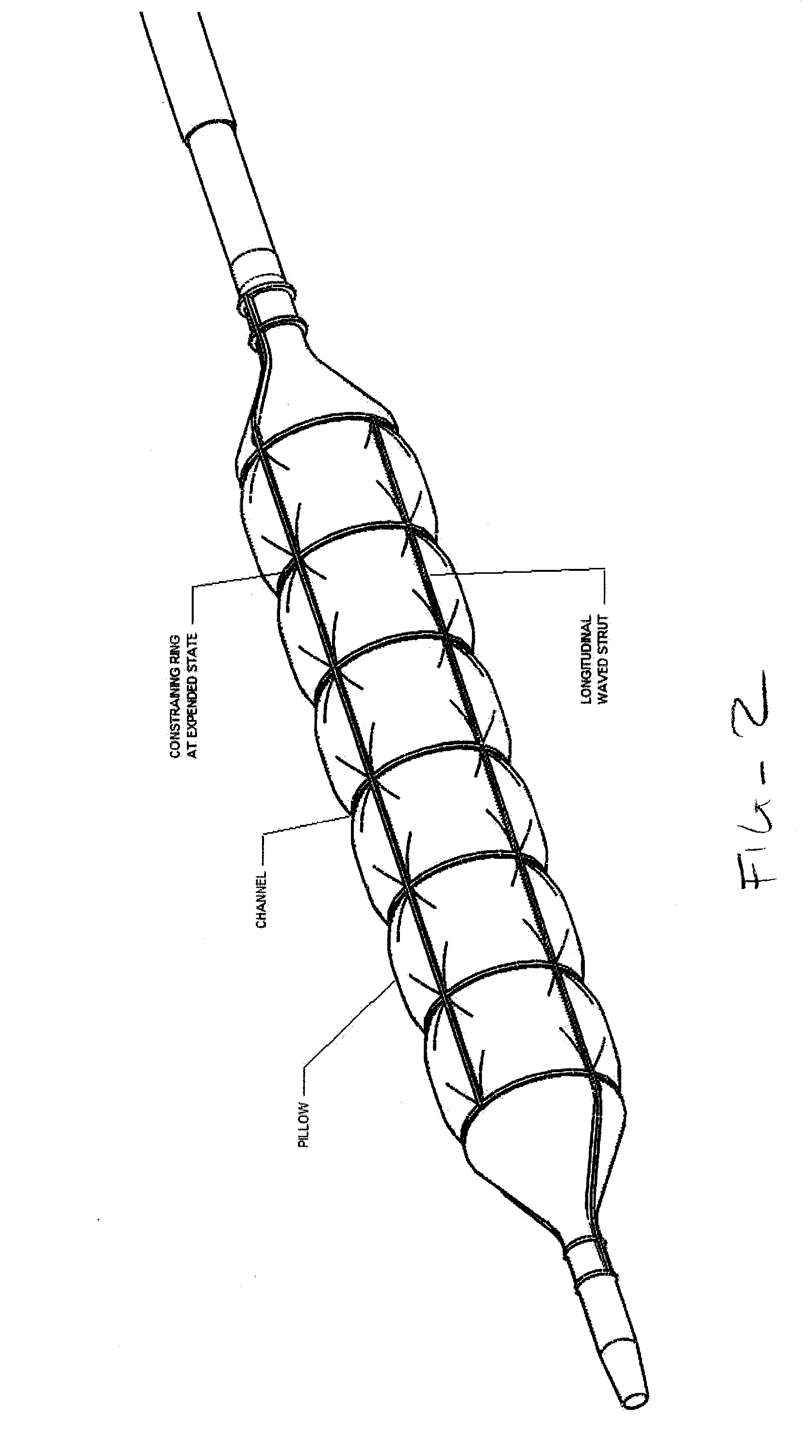 Constraining structure with non-linear axial struts