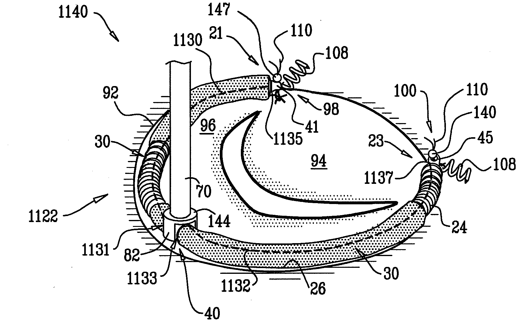 Adjustable partial annuloplasty ring and mechanism therefor