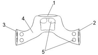 Preparation method of ultrasonic-assisted customized 3D printing medical porous renewable sacrum prosthesis