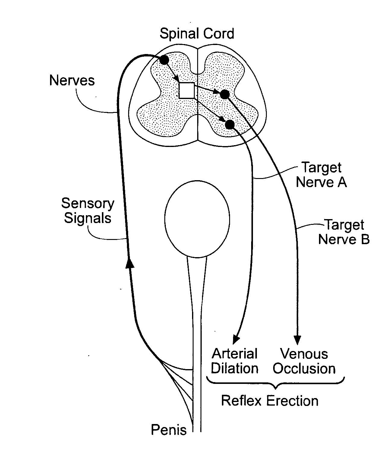 Systems and methods of neuromodulation stimulation for the restoration of sexual function