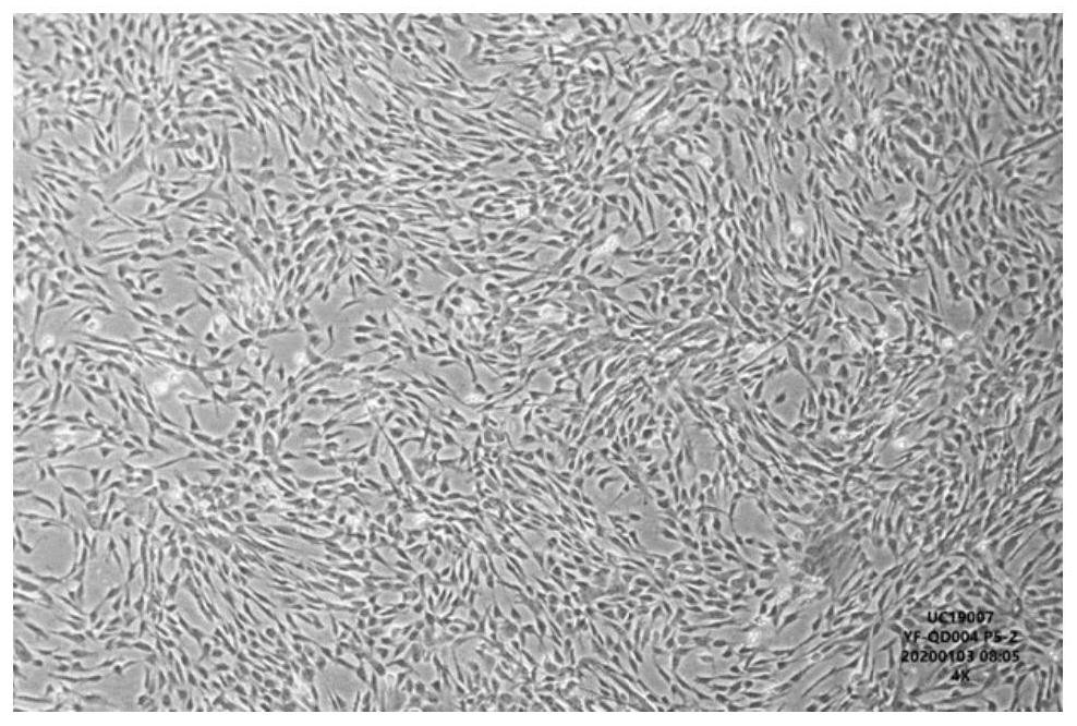 Cryopreservation liquid for long-term preservation of human umbilical cord mesenchymal stem cells