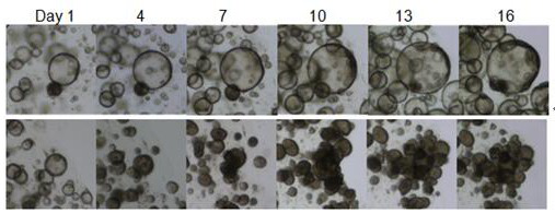 Standardized culture medium and culture method for three-dimensional culture of lung and lung cancer tissue organoids