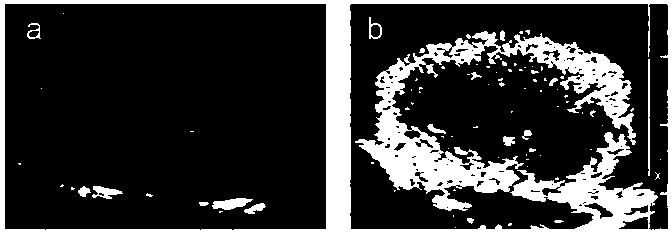 A kind of pentaerythritol ester-based ultrasound contrast agent and its preparation method and application