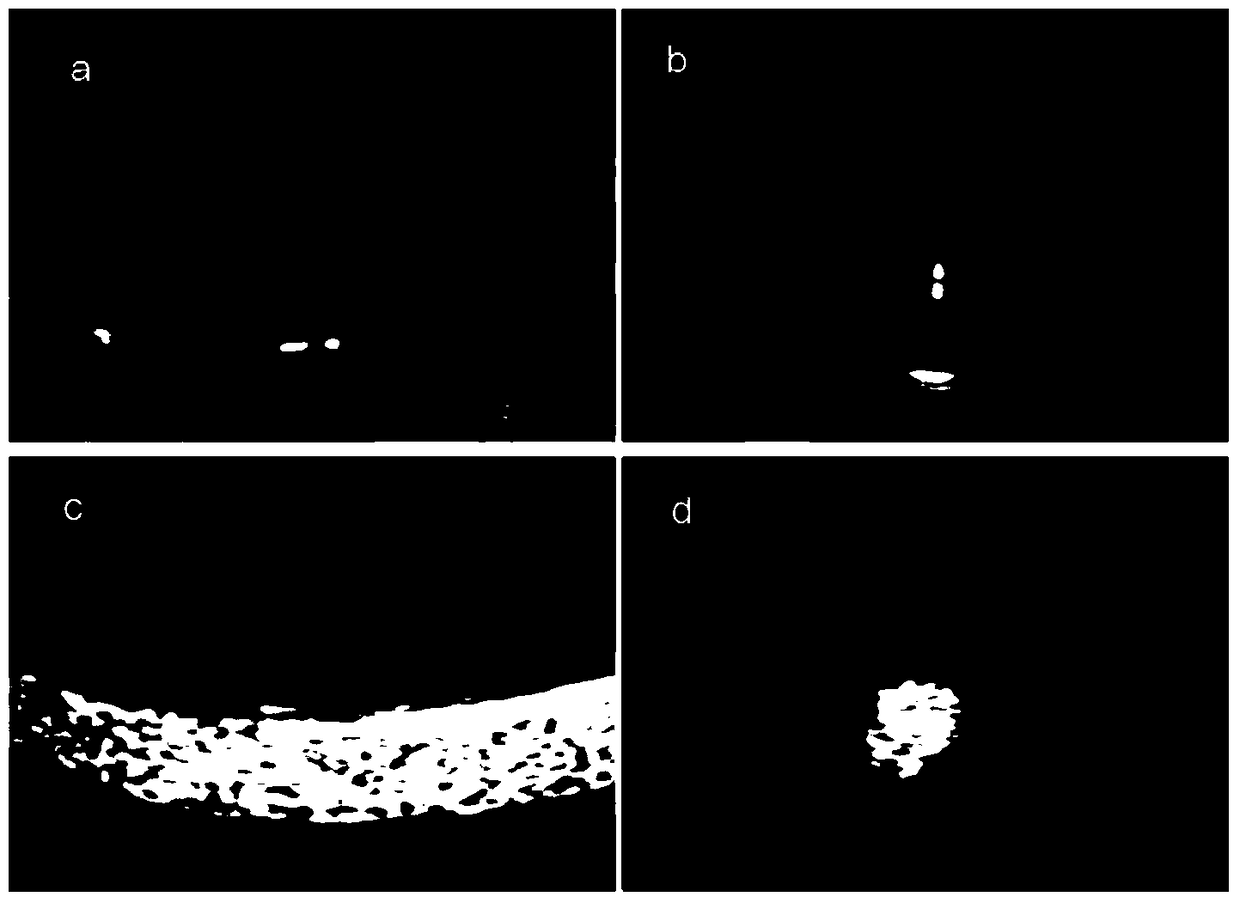 A kind of pentaerythritol ester-based ultrasound contrast agent and its preparation method and application