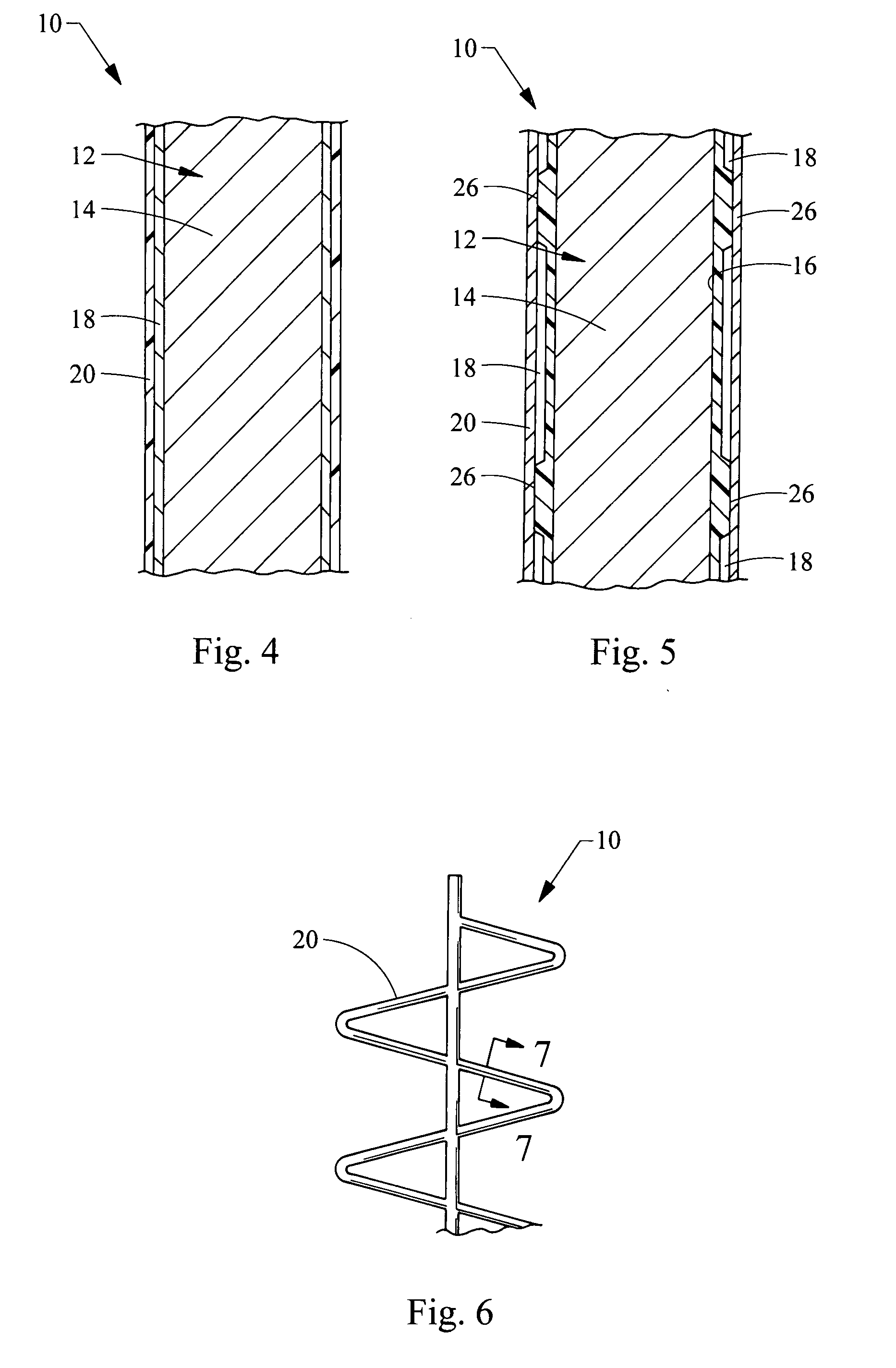 Endoluminal medical device for local delivery of cathepsin inhibitors, method of making and treating